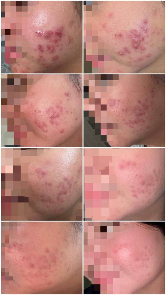 You don’t need strong serums ‼️