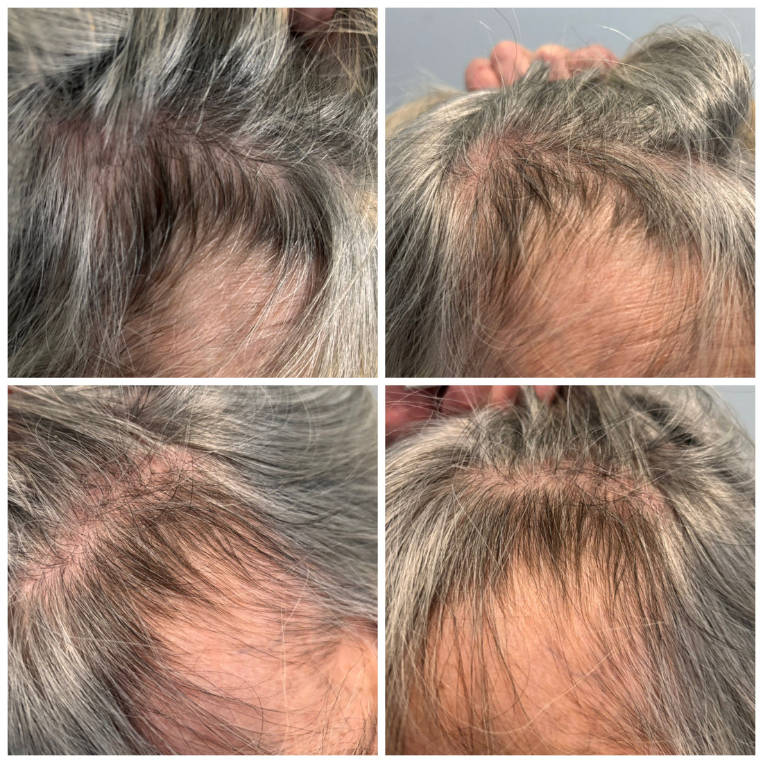 The darker hairs you see are all new growth‼️