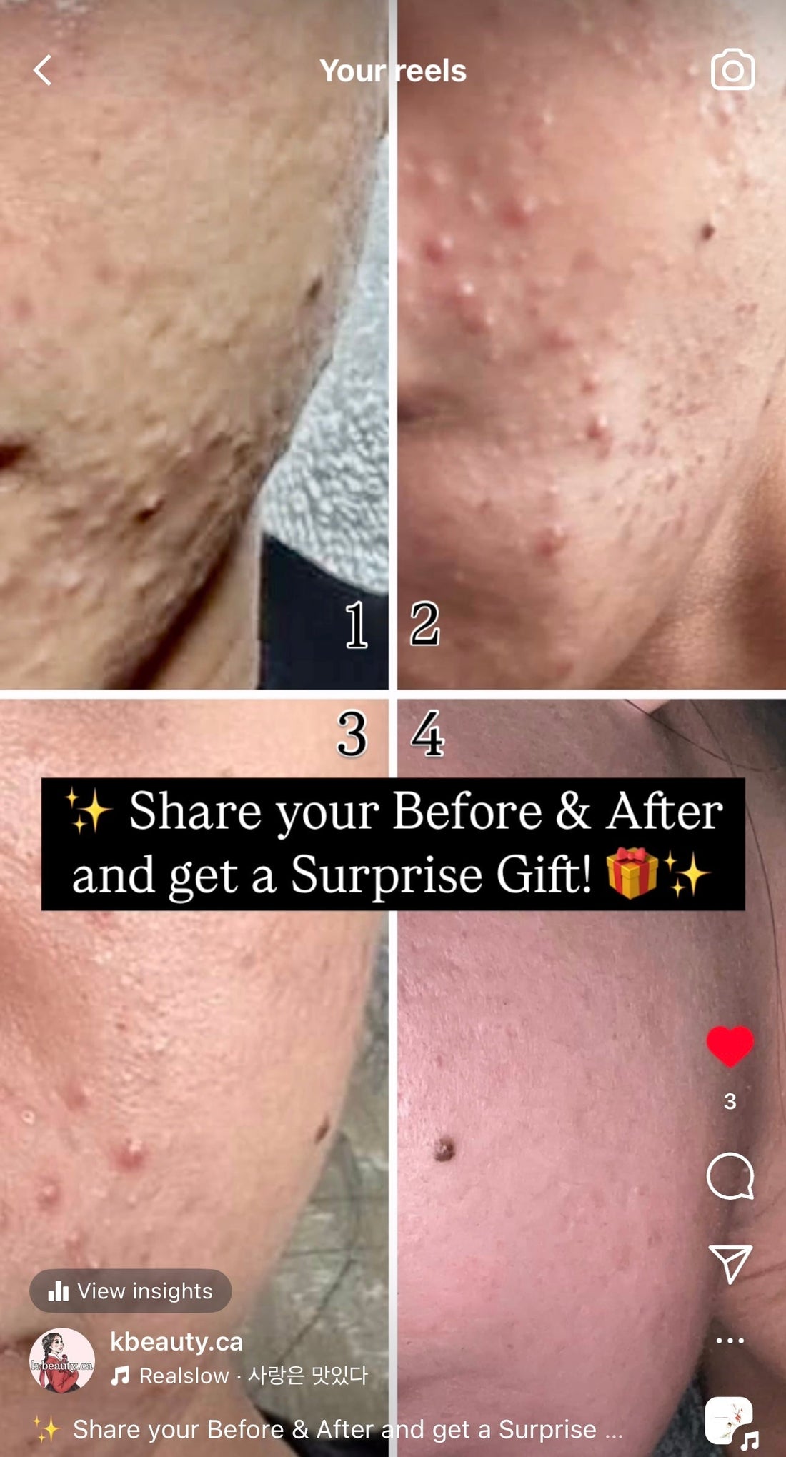 ✨ Share your Before & After and get a Surprise Gift! 🎁✨