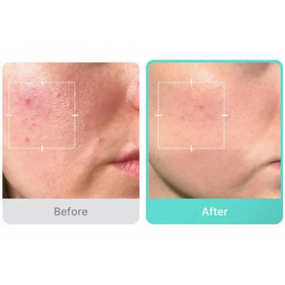 [Medicube] Azelaic Acid 16 BB Soothing Serum 30ml