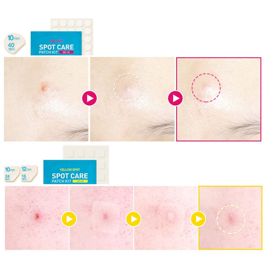 [HATHERINE] Spot Care Patch Kit 76 patches