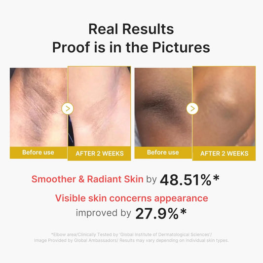 [Medicube] Kojic Acid Turmeric Body Peel Shot 280ml
