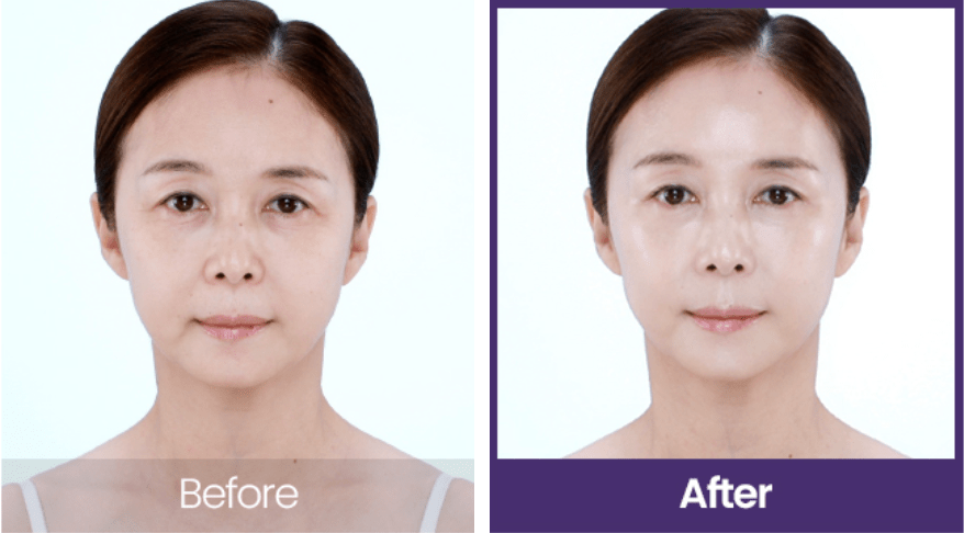 [A.H.C] Premier Ampoule Eye Cream For Face Line Tightening 40ml