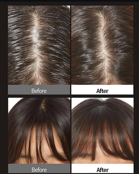 [APIEU] Oily Hair Dry Powder 5g