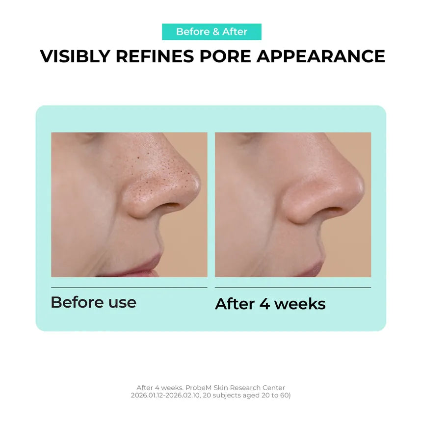 [Jumiso] Overnight Zero Nose Patch (10 Patches)