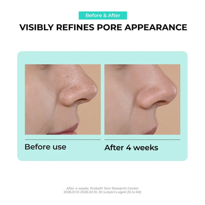[Jumiso] Overnight Zero Nose Patch (10 Patches)