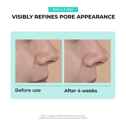 [Jumiso] Overnight Zero Nose Patch (10 Patches)