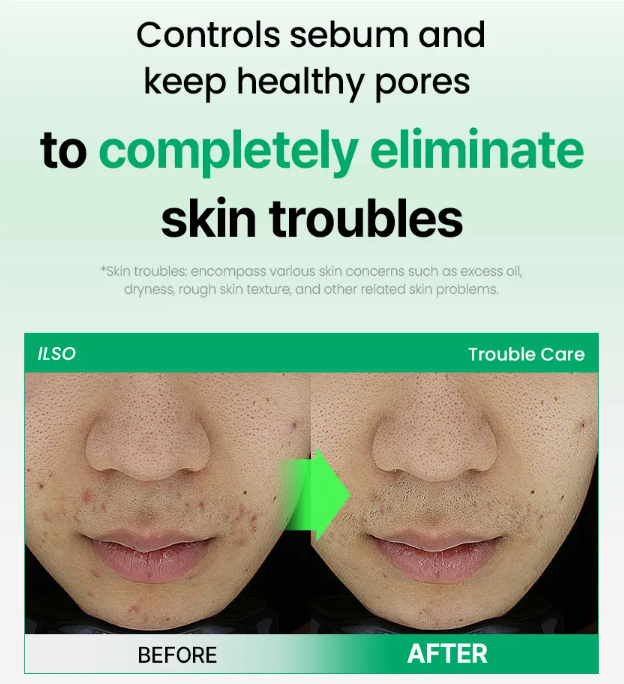 [ilso] No Problem Spot Softener Special Set