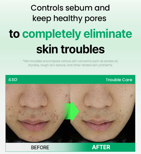 [ilso] No Problem Spot Softener Special Set