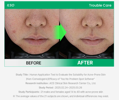 [ilso] No Problem Spot Softener Special Set